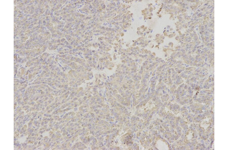 Immunohistochemistry - APOM Antibody from Signalway Antibody (32780) - Antibodies.com
