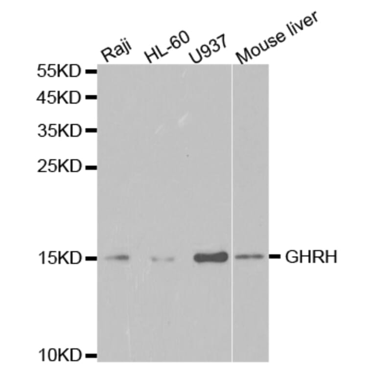Western blot - GHRH Antibody from Signalway Antibody (32784) - Antibodies.com