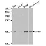 Western blot - GHRH Antibody from Signalway Antibody (32784) - Antibodies.com