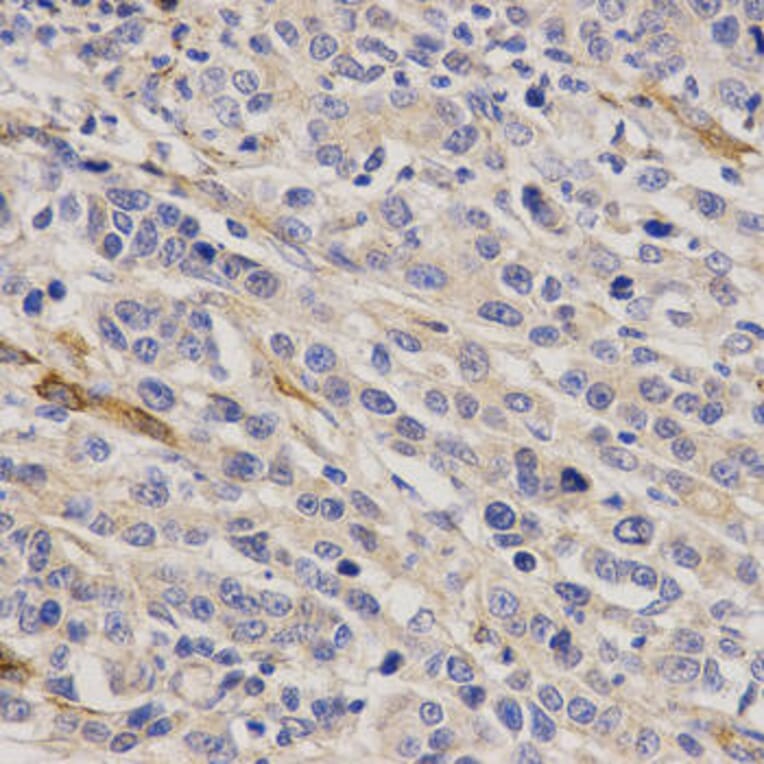 Immunohistochemistry - GHRH Antibody from Signalway Antibody (32784) - Antibodies.com