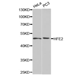 Western blot - HFE2 Antibody from Signalway Antibody (32789) - Antibodies.com