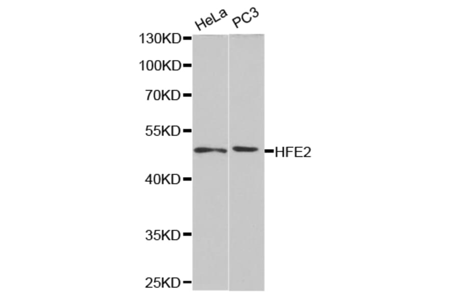 Western blot - HFE2 Antibody from Signalway Antibody (32789) - Antibodies.com