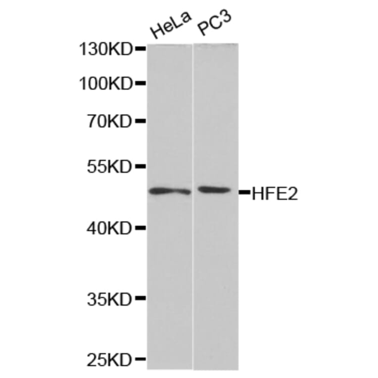 Western blot - HFE2 Antibody from Signalway Antibody (32789) - Antibodies.com