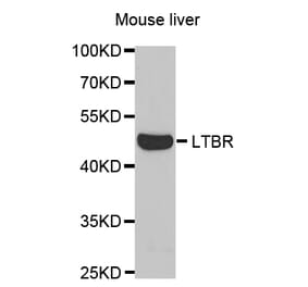 Western blot - LTBR Antibody from Signalway Antibody (32791) - Antibodies.com