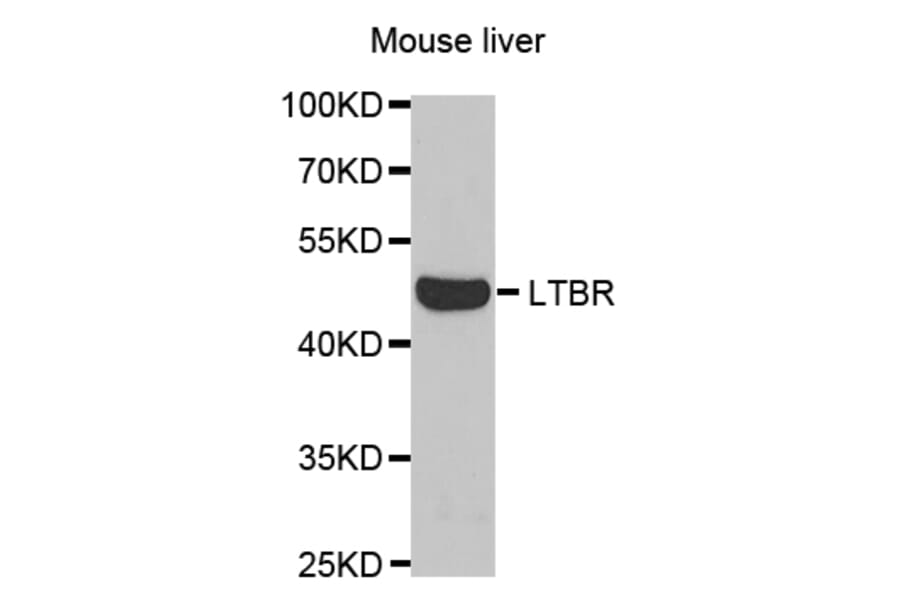 Western blot - LTBR Antibody from Signalway Antibody (32791) - Antibodies.com
