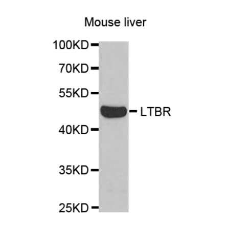 Western blot - LTBR Antibody from Signalway Antibody (32791) - Antibodies.com