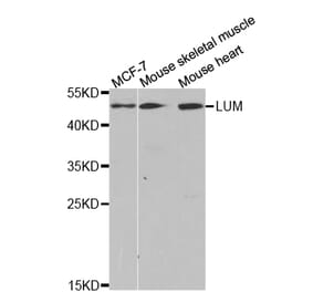 Western blot - LTBR Antibody from Signalway Antibody (32792) - Antibodies.com