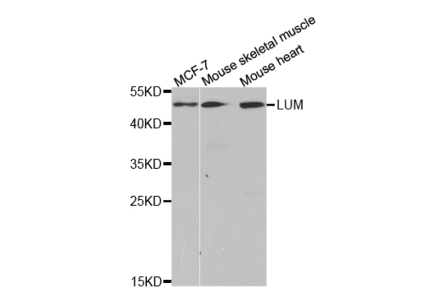 Western blot - LTBR Antibody from Signalway Antibody (32792) - Antibodies.com