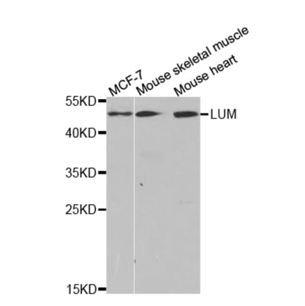 Western blot - LTBR Antibody from Signalway Antibody (32792) - Antibodies.com