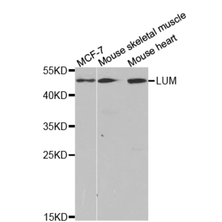 Western blot - LTBR Antibody from Signalway Antibody (32792) - Antibodies.com