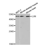 Western blot - LTBR Antibody from Signalway Antibody (32792) - Antibodies.com