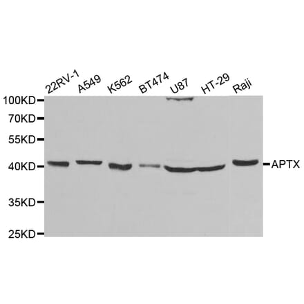 Western blot - APTX Antibody from Signalway Antibody (32804) - Antibodies.com