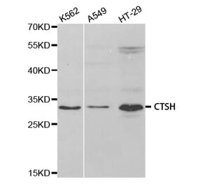 Western blot - CTSH Antibody from Signalway Antibody (32808) - Antibodies.com