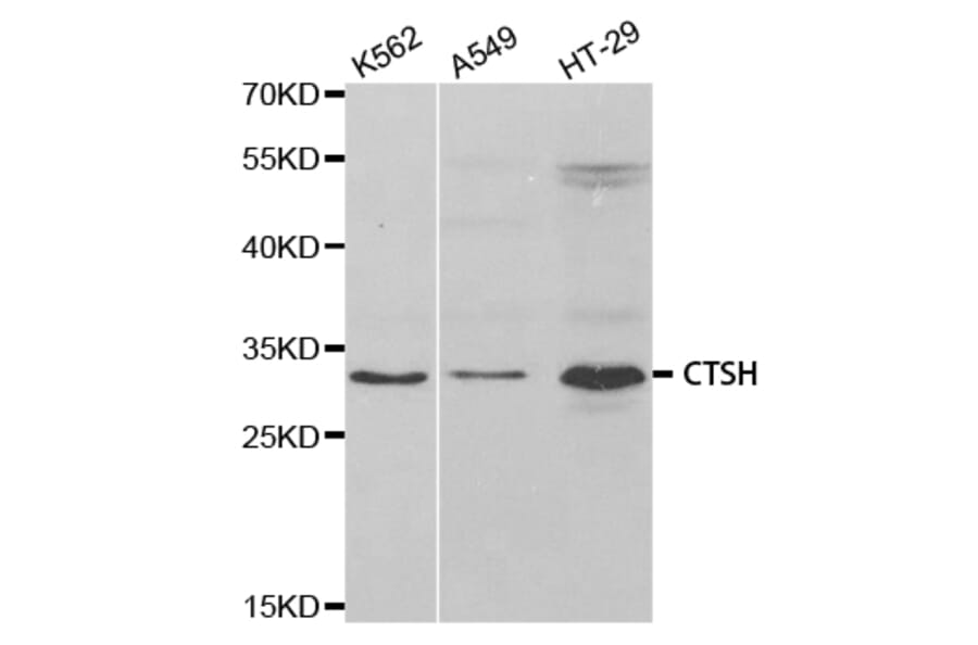 Western blot - CTSH Antibody from Signalway Antibody (32808) - Antibodies.com