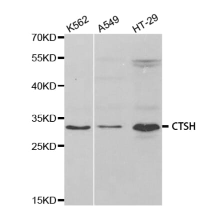 Western blot - CTSH Antibody from Signalway Antibody (32808) - Antibodies.com