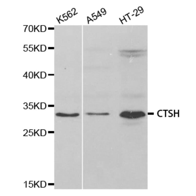Western blot - CTSH Antibody from Signalway Antibody (32808) - Antibodies.com