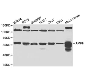 Western blot - AMPH Antibody from Signalway Antibody (32823) - Antibodies.com