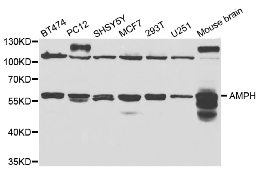 Western blot - AMPH Antibody from Signalway Antibody (32823) - Antibodies.com