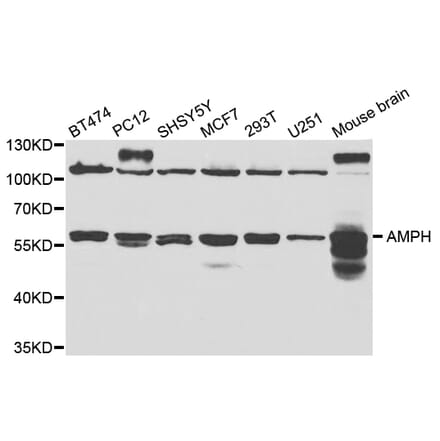 Western blot - AMPH Antibody from Signalway Antibody (32823) - Antibodies.com