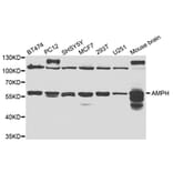 Western blot - AMPH Antibody from Signalway Antibody (32823) - Antibodies.com