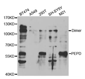 Western blot - PEPD Antibody from Signalway Antibody (32842) - Antibodies.com