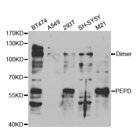 Western blot - PEPD Antibody from Signalway Antibody (32842) - Antibodies.com