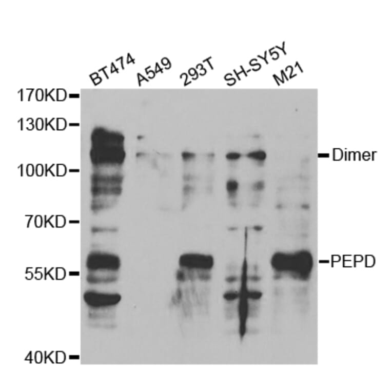 Western blot - PEPD Antibody from Signalway Antibody (32842) - Antibodies.com