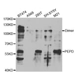 Western blot - PEPD Antibody from Signalway Antibody (32842) - Antibodies.com