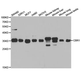 Western blot - CBR1 Antibody from Signalway Antibody (32853) - Antibodies.com