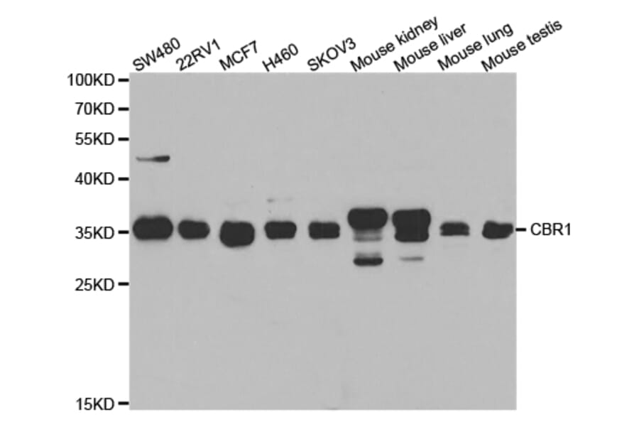 Western blot - CBR1 Antibody from Signalway Antibody (32853) - Antibodies.com