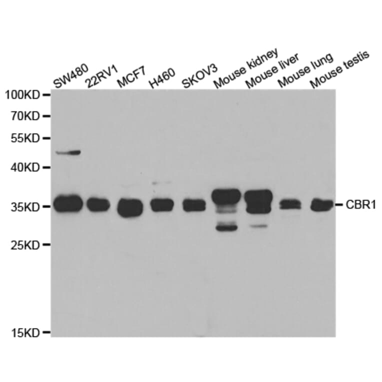 Western blot - CBR1 Antibody from Signalway Antibody (32853) - Antibodies.com