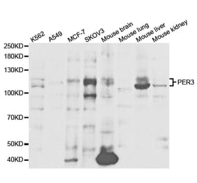 Western blot - PER3 Antibody from Signalway Antibody (32856) - Antibodies.com