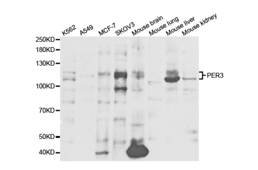 Western blot - PER3 Antibody from Signalway Antibody (32856) - Antibodies.com
