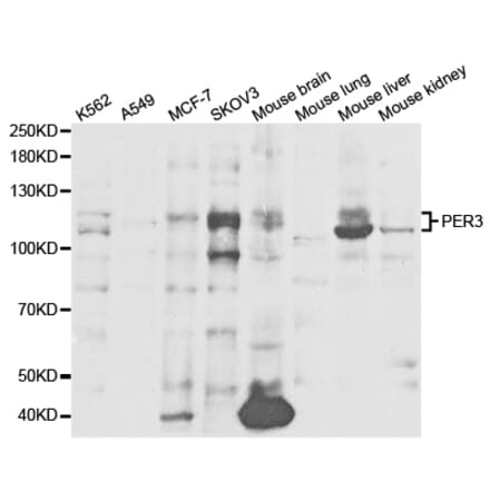 Western blot - PER3 Antibody from Signalway Antibody (32856) - Antibodies.com