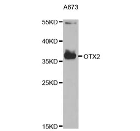 Western blot - OTX2 Antibody from Signalway Antibody (32873) - Antibodies.com