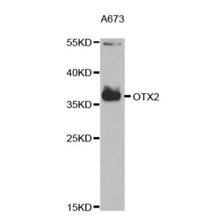 Western blot - OTX2 Antibody from Signalway Antibody (32873) - Antibodies.com