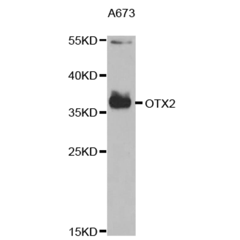 Western blot - OTX2 Antibody from Signalway Antibody (32873) - Antibodies.com