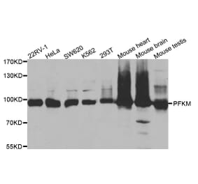 Western blot - PFKM Antibody from Signalway Antibody (32875) - Antibodies.com
