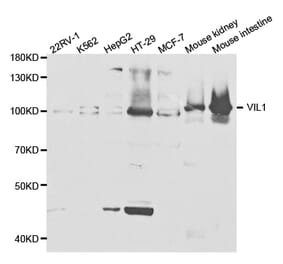 Western blot - VIL1 Antibody from Signalway Antibody (32887) - Antibodies.com