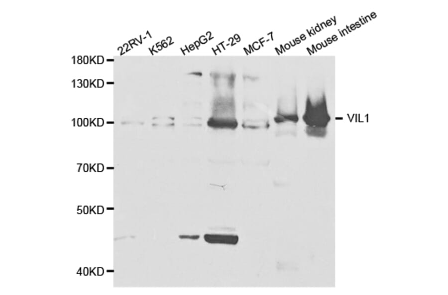 Western blot - VIL1 Antibody from Signalway Antibody (32887) - Antibodies.com