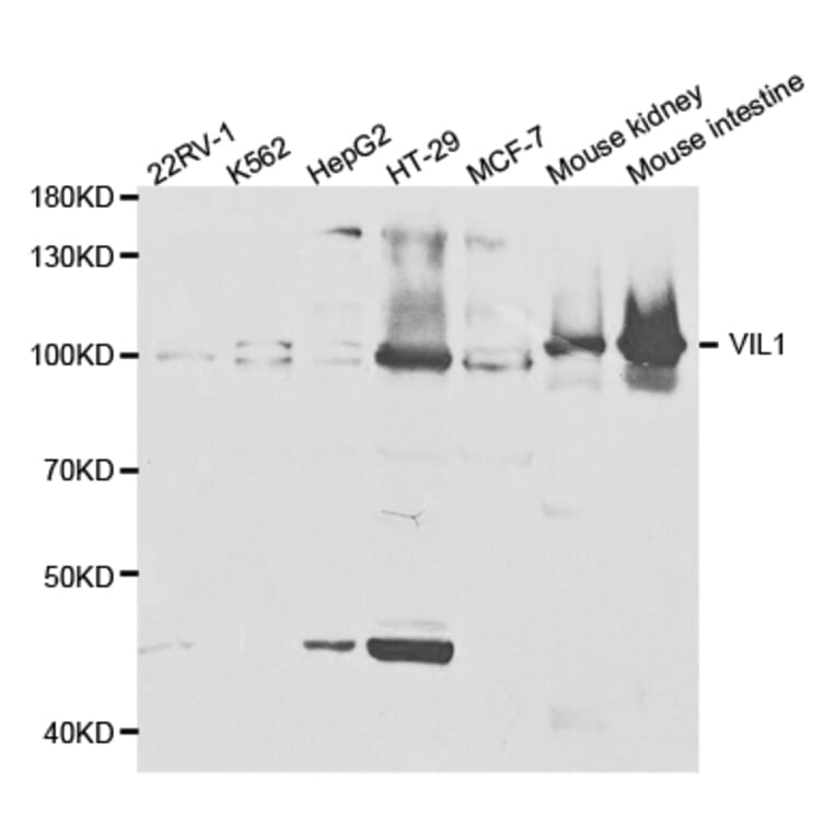 Western blot - VIL1 Antibody from Signalway Antibody (32887) - Antibodies.com