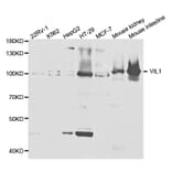 Western blot - VIL1 Antibody from Signalway Antibody (32887) - Antibodies.com