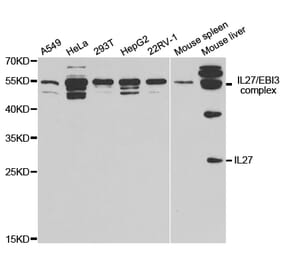 Western blot - IL27 Antibody from Signalway Antibody (32888) - Antibodies.com