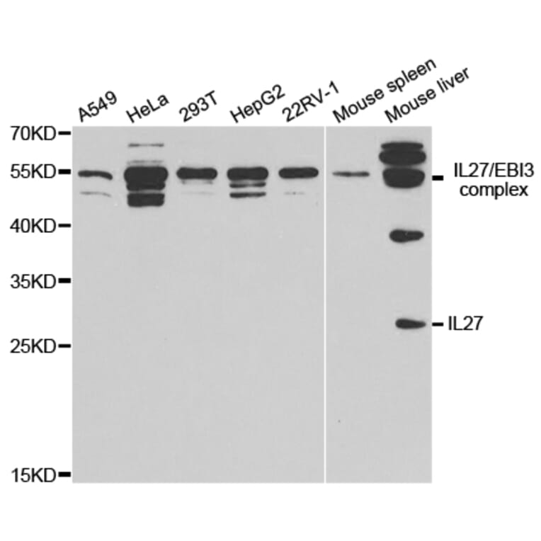 Western blot - IL27 Antibody from Signalway Antibody (32888) - Antibodies.com