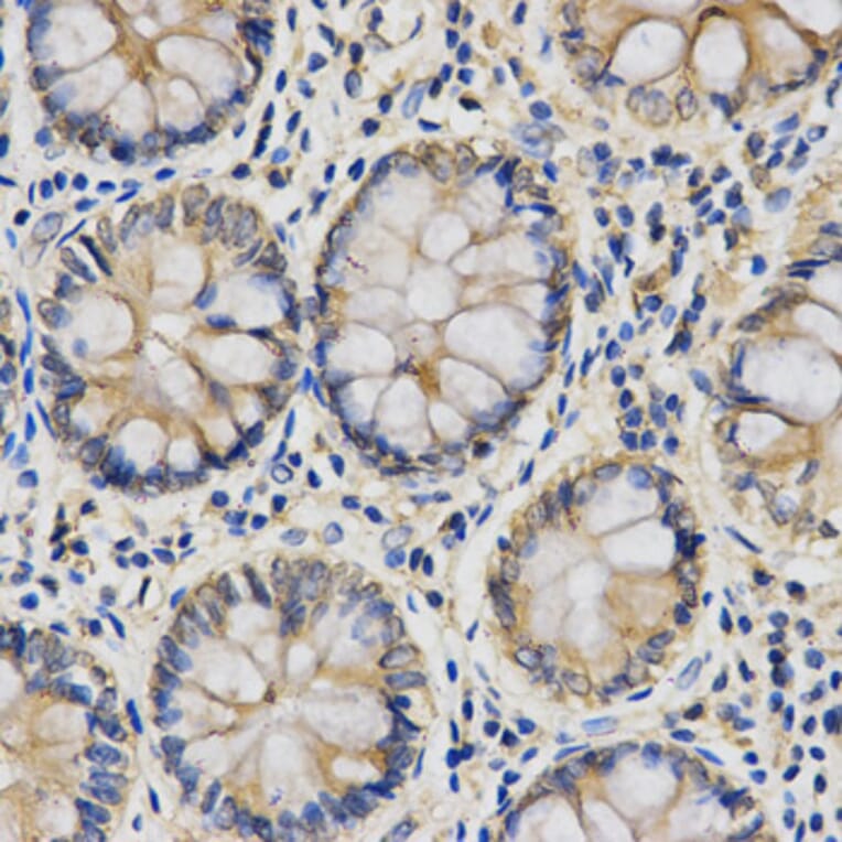 Immunohistochemistry - IL27 Antibody from Signalway Antibody (32888) - Antibodies.com