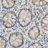 Immunohistochemistry - IL27 Antibody from Signalway Antibody (32888) - Antibodies.com