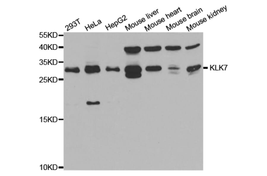 Western blot - KLK7 Antibody from Signalway Antibody (32896) - Antibodies.com