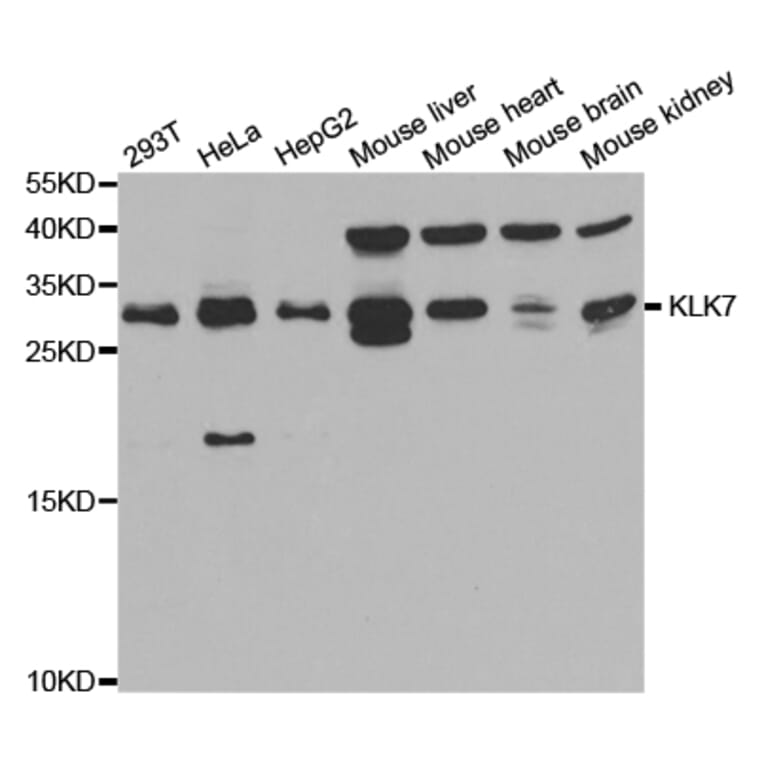 Western blot - KLK7 Antibody from Signalway Antibody (32896) - Antibodies.com