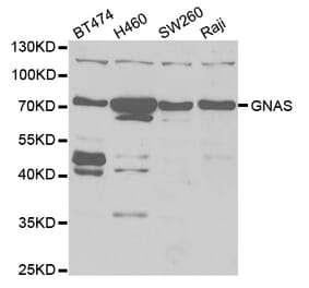 Western blot - GNAS Antibody from Signalway Antibody (32899) - Antibodies.com