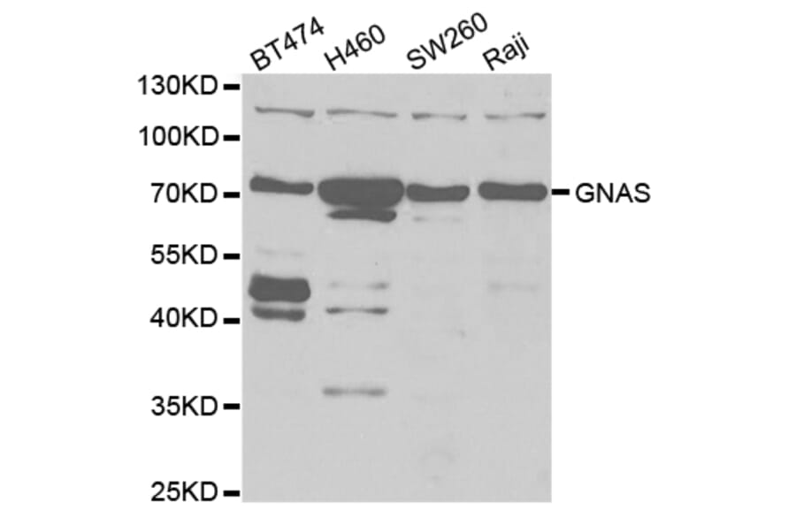 Western blot - GNAS Antibody from Signalway Antibody (32899) - Antibodies.com